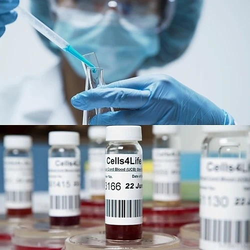 Стволови клетки излекуваха критично болен пациент с COVID 19