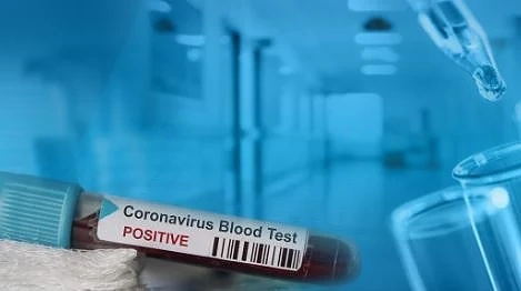 10-та жертва. 40-годишен мъж с COVID-19 почина в „Пирогов“