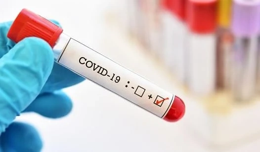 503 са потвърдените случаи на COVID-19 у нас