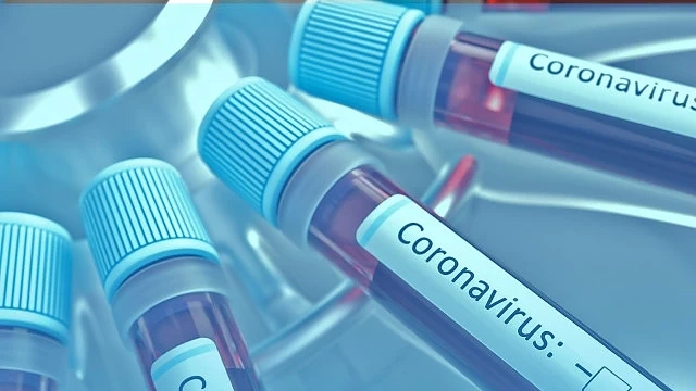 Вижте гневния коментар на млада българка преболедувала COVID-19
