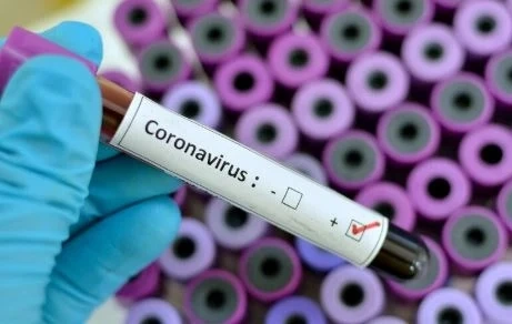 1024 са вече потвърдените случаи на COVID-19 у нас
