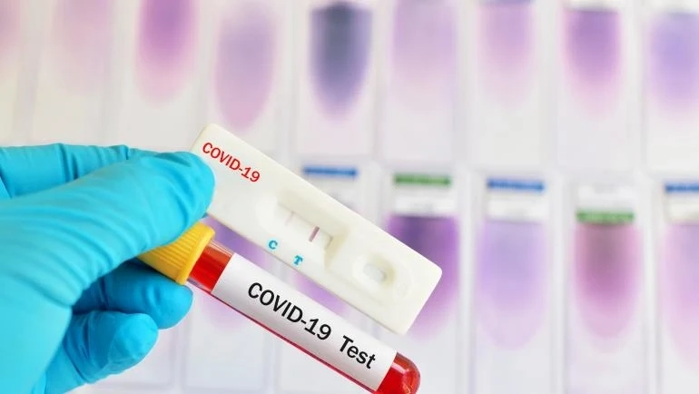 Над 1 500 са вече заразените с Covid-19 у нас