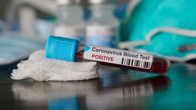 57 нови случаи на COVID-19 у нас, 7 от тях са деца
