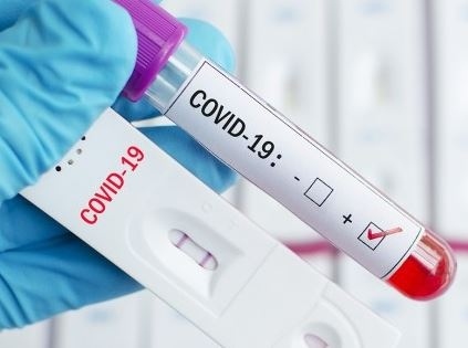 Започва масово тестване за COVID-19 в Бургас