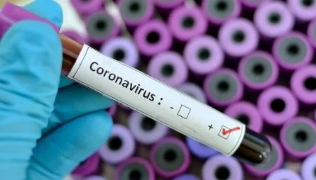 24 са новите случаи на коронавирус у нас