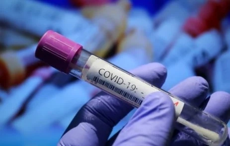 Разпространението на COVID-19 в София е дифузно, а не клъстерно
