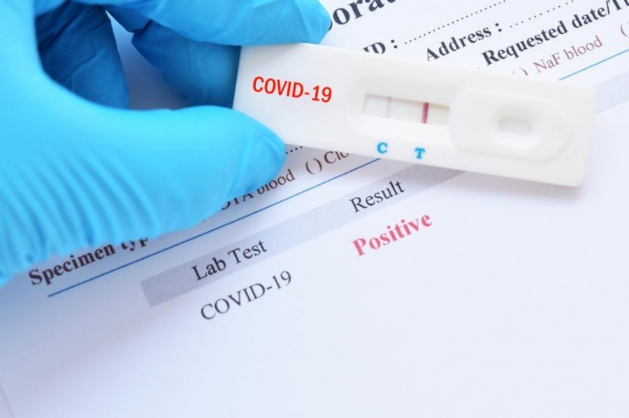 САЩ с антирекорд за трети пореден ден за случаи на COVID-19!