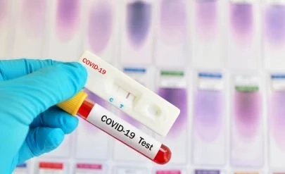 189 нови случаи на заразени с Covid-19 у нас