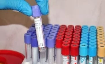 119 са новите случаи на COVID-19 у нас