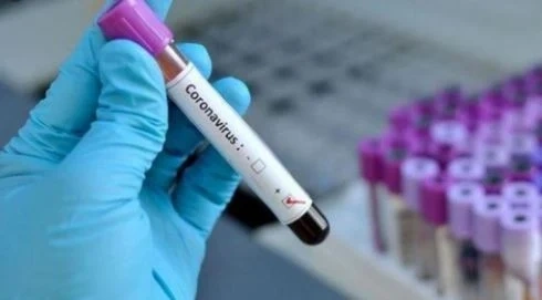 210 нови случая на COVID-19, починалите отново са 12
