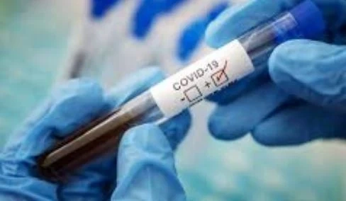 162 нови случая и 14 починали с COVID-19 у нас