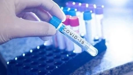 201 са новите случаи на коронавирус у нас