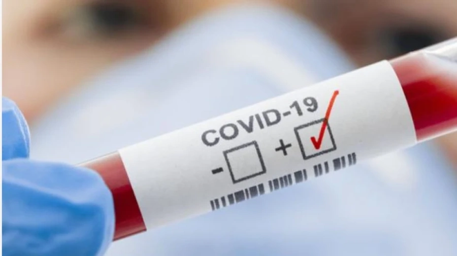 182 са новите случаи на COVID-19 у нас