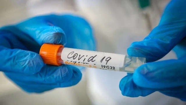603 нови случая на COVID-19 у нас