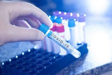 85 починали и 4212 новозаразени с COVID-19 у нас