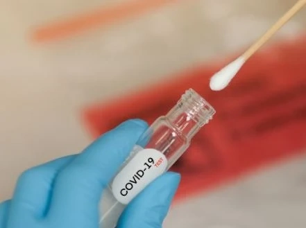 3 138 са новите случаи на COVID - 19 у нас