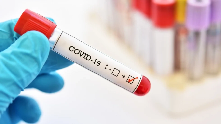 Редица държави затягат драстично Covid мерките