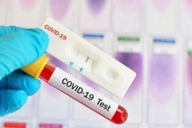 772 са новите случаи на COVID-19 у нас или 21% от изследваните