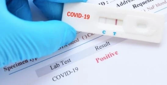 Малко над 12% положителни проби за COVID-19 за последното денонощие