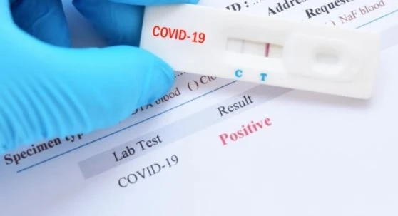 274 са новите случаи на COVID-19 у нас