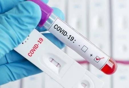 566 нови случая на COVID-19 у нас за денонощие