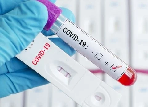 София начело по брой заразени с COVID-19
