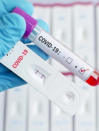 Рязък скок на новите случаи на COVID-19 за денонощие