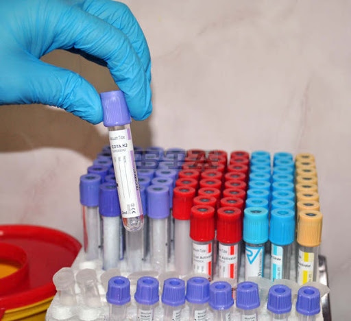 3 556 са новите случаи на COVID 19 у нас Направени са