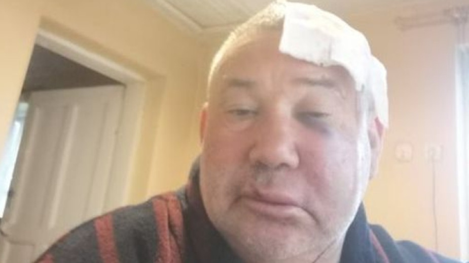 Националното сдружение на кметовете на кметства осъди побоя над кмета