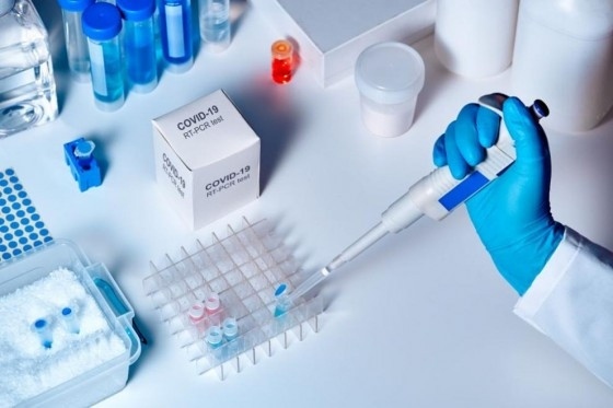 Кипър е на първо място в ЕС по провеждане на тестове за коронавирус