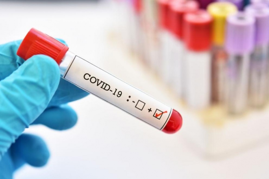 Над 1000 нови случая на COVID-19 у нас за последното денонощие