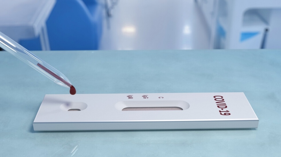 Кога се прави тест за антитела