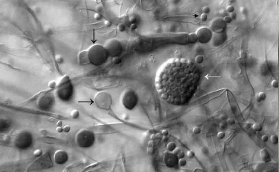 Коронавирусът продължава да се разпространява с бързи темпове в Индия