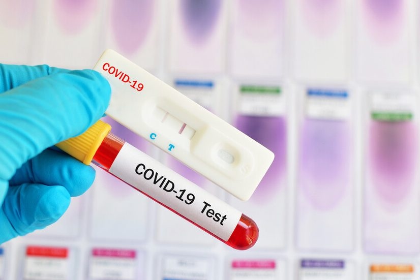 393 са новите случаи на коронавирус у нас за последното