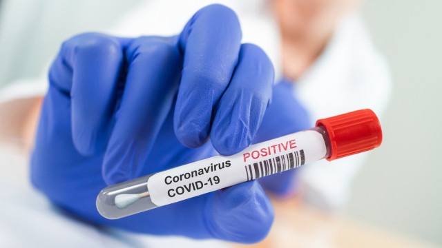 94 са новите случаи на коронавирус в страната за изминалото