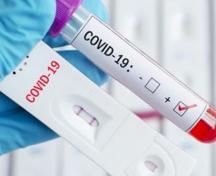 74 са новите случаи на коронавирус у нас за последните