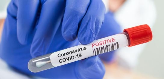 216 са новите случаи на коронавирус у нас Направените изследвания