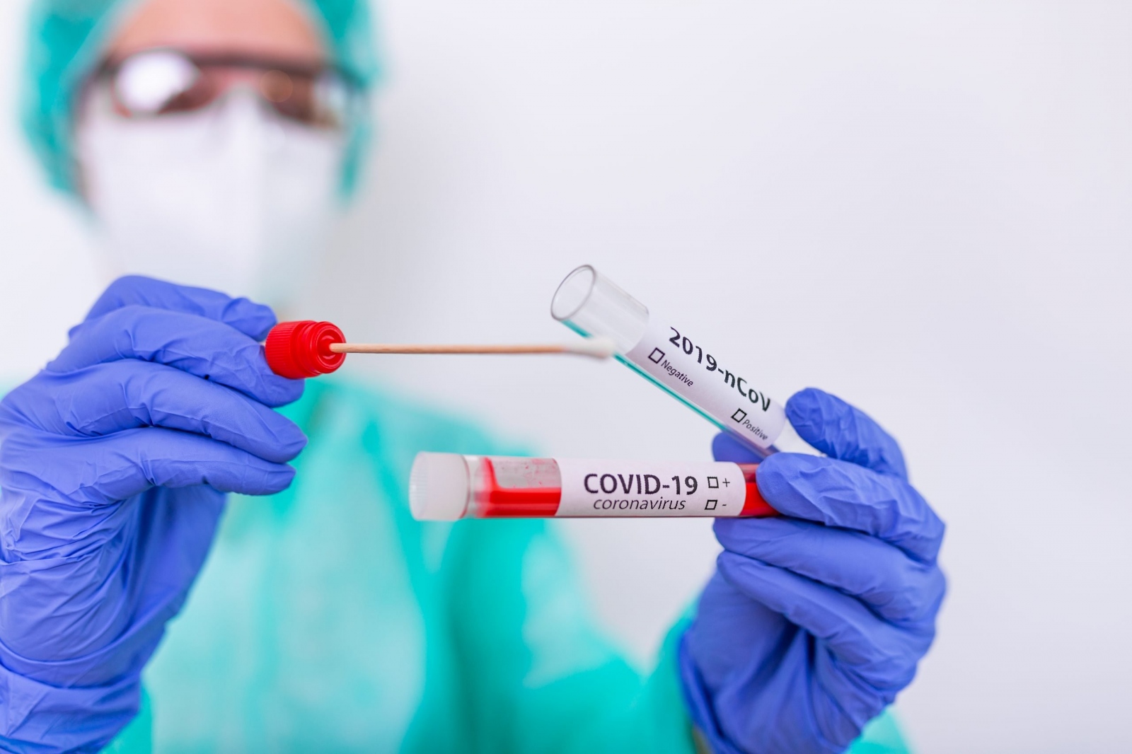 182 са новите случаи на коронавирус през последното денонощие при