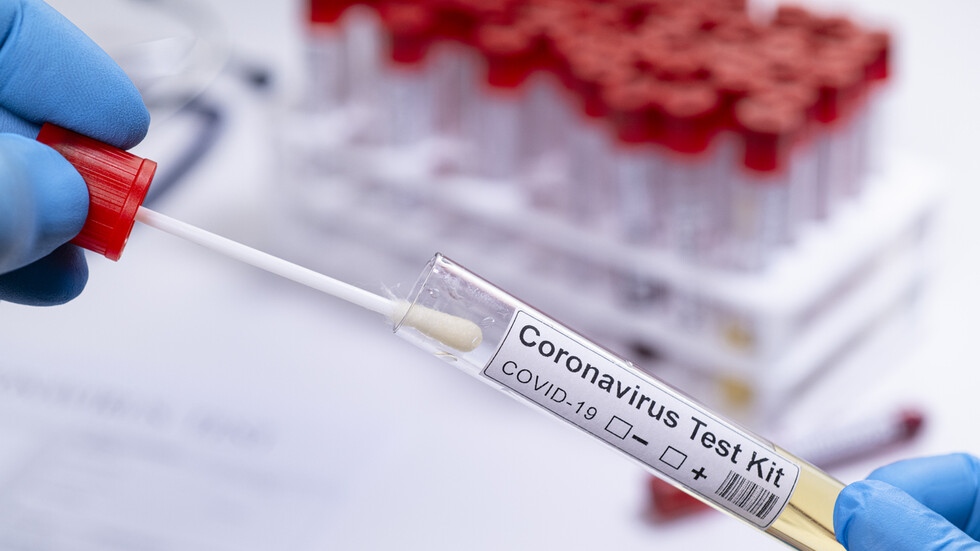 Тестовете за COVID-19 без лекарско предписание ще станат платени от