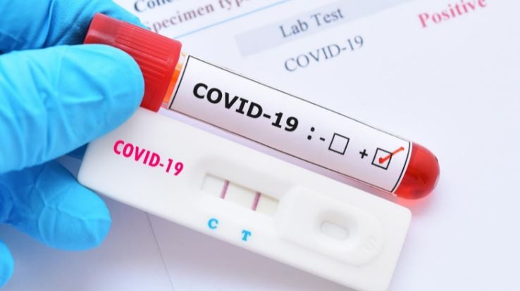 1911 нови случая на заразени с COVID 19 през последното денонощие