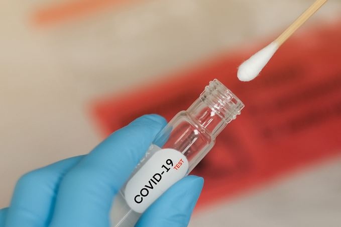 Ръст на новозаразените и починалите от COVID 19 у нас отчита