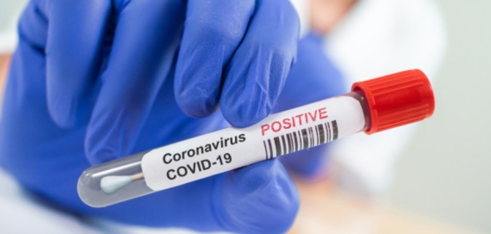 9 5 са положителните проби за коронавирусна инфекция за последните 24