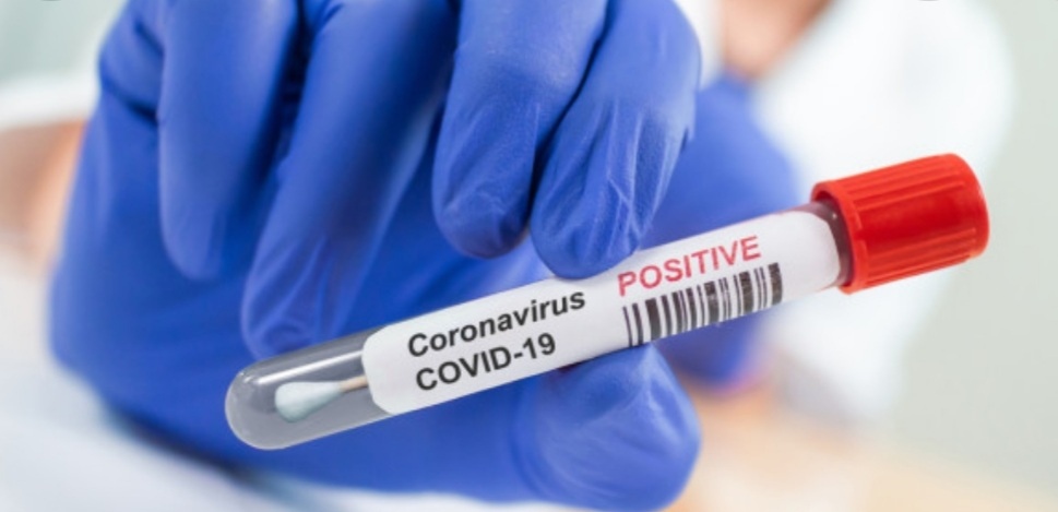 496 са новите случаи на заразени с коронавирус от направените