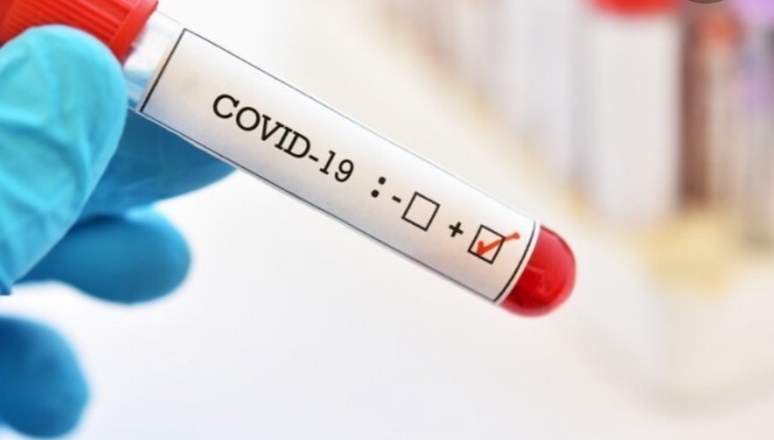 3183 са новите случаи на коронавирус у нас