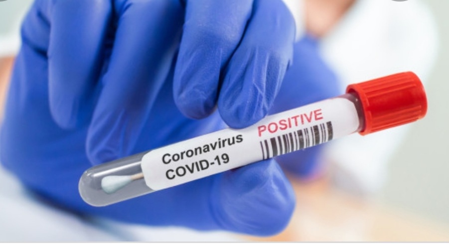 4522 нови случая на заразени с COVID 19 през последното денонощие
