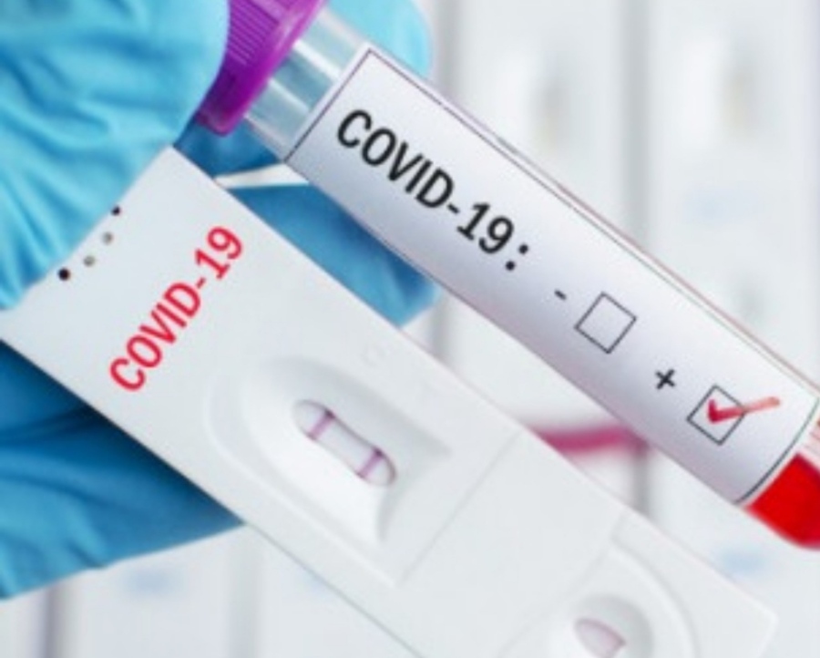 1256 са новите случаи на коронавирус