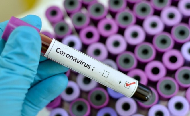 Случаите на заразяване с коронавирус в света надхвърлиха 250 милиона