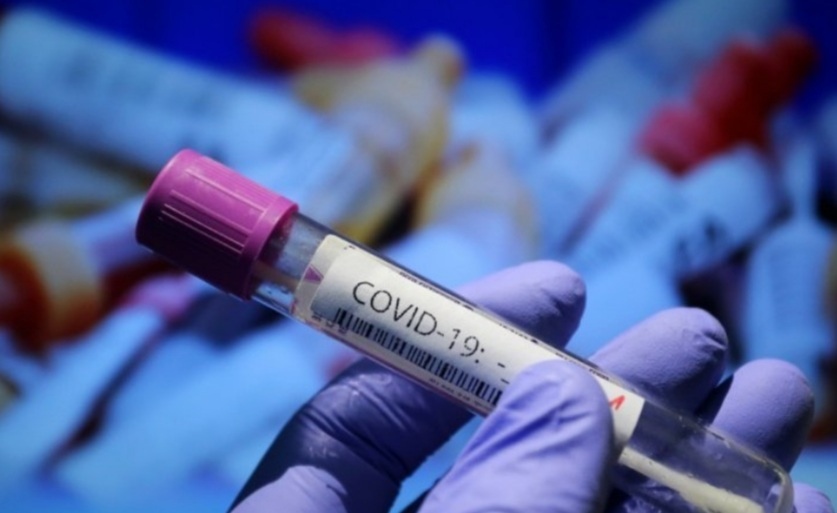 3853 са новите случаи на коронавирус у нас Това са