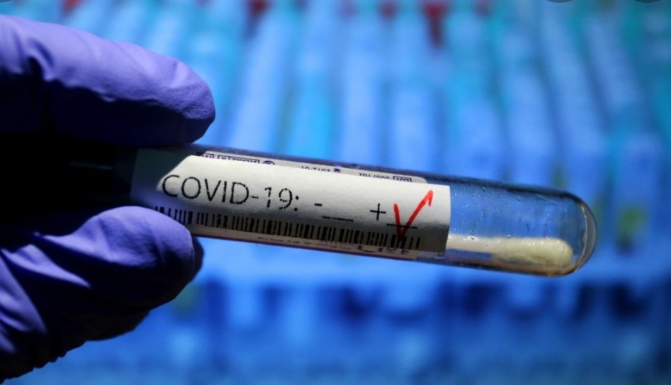 728 нови случаи на коронавирус са отчетени в неделя Направени