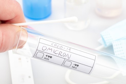 Омикрон може да се окаже прекрасен коледен подарък смята германският